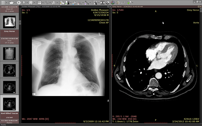 RadiAnt DICOM Viewer картинка №32304